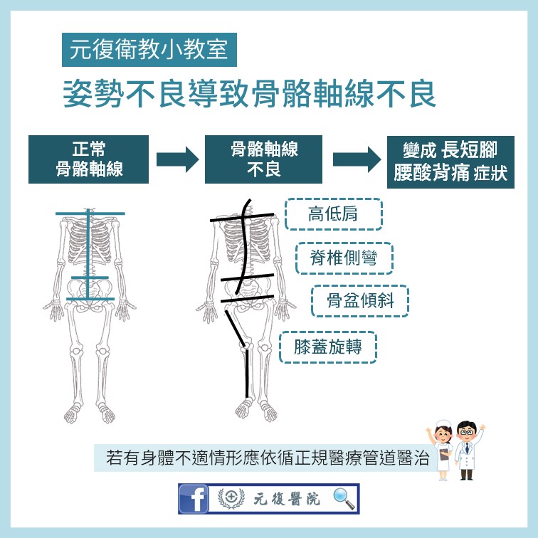 元復衛教小教室 / 常常腰痠背痛的原因？如何預防退化性關節炎？
