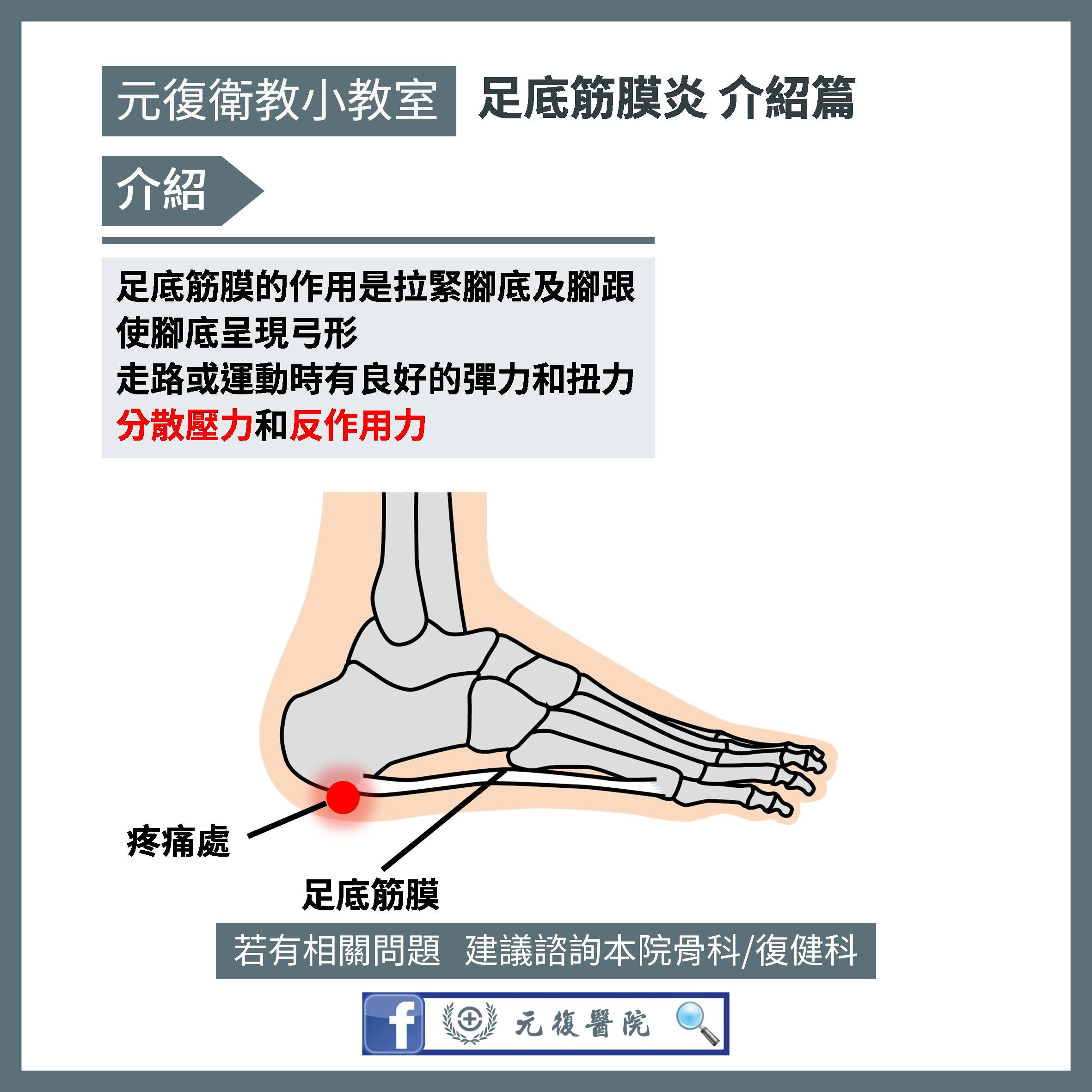 元復衛教小教室 / 告別早晨腳底痛：足底筋膜炎的預防與治療