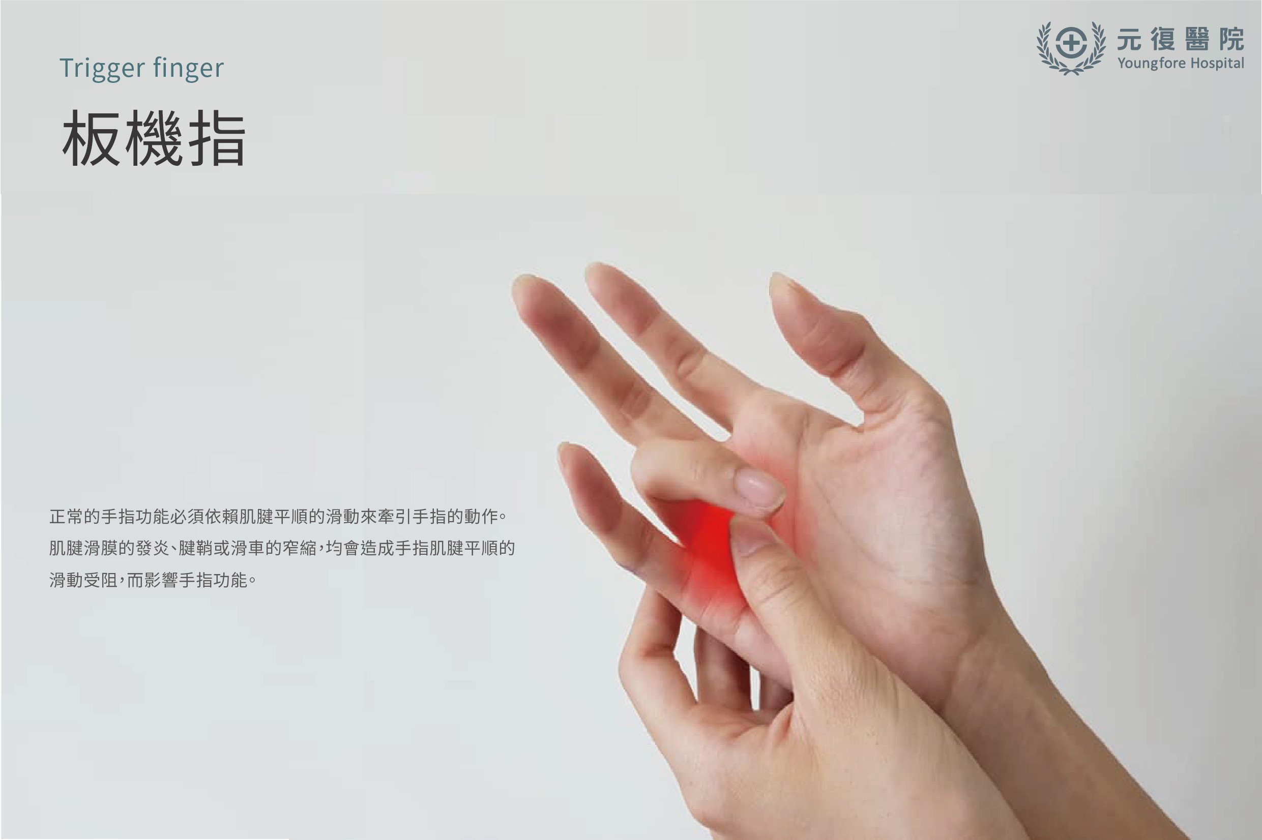 板機指