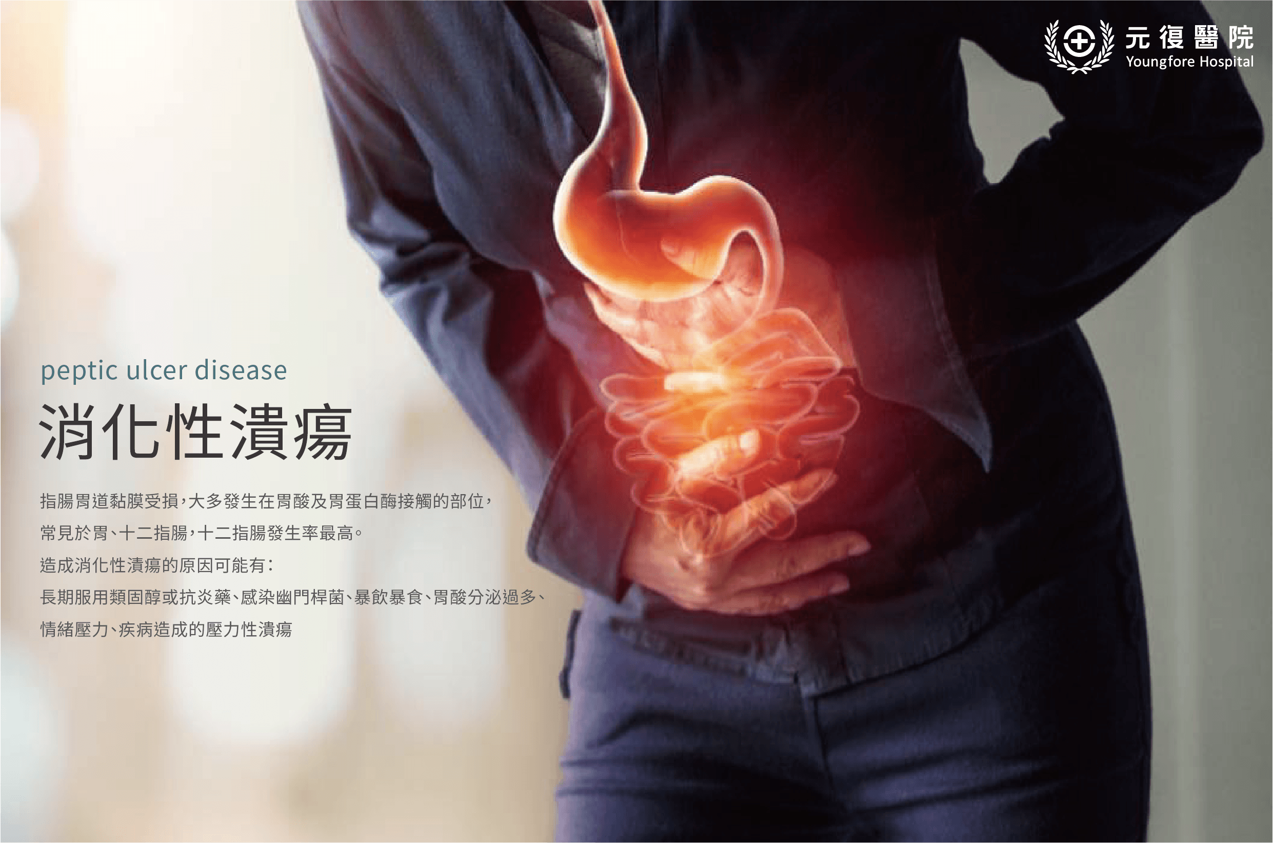 消化性潰瘍