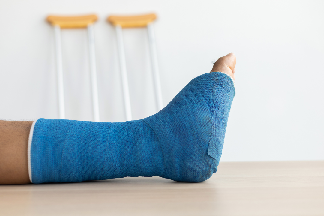 骨折復健黃金期怎麼把握？最佳治療時機與康復重點